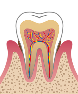 2.軽度歯周病